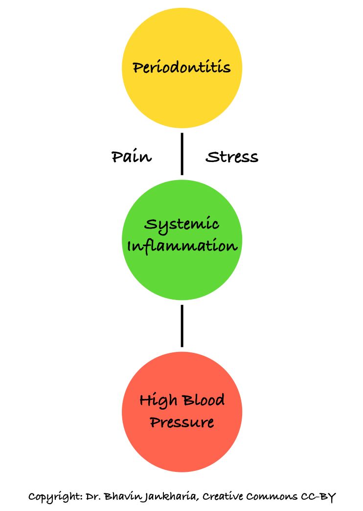 Bad Gums and High Blood Pressure